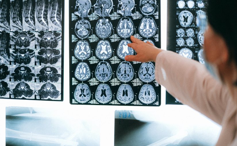 Alzheimer’s: what’s on the horizon?